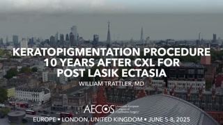 47 - Keratopigmentation Procedure 10 Years after CXL for Post LASIK Ectasia - William Trattler, MD [1105909793].mp4